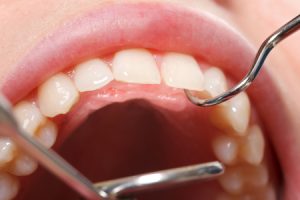 Oral Cancer Examination